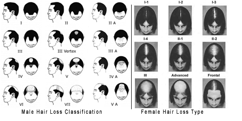 Hair Loss Scale