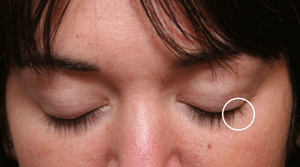 SWMD (EYELASH) BEFORE cropped