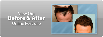 portfolio_before_after_button
