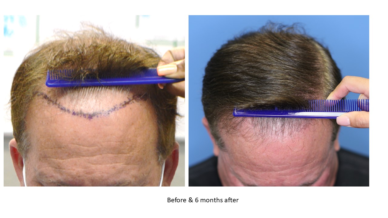 1/6 Joe ヘッド with Hair Implantation Slide3-4.jpg