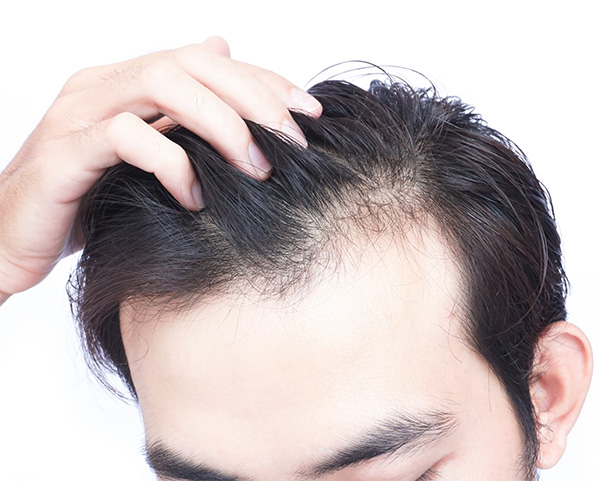 What is Shock Hair Loss After Surgery? - Articles - Sara Wasserbauer MD